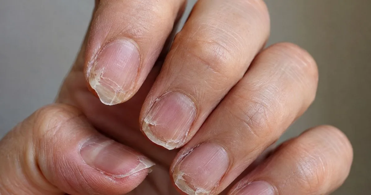 Hábitos do dia a dia podem enfraquecer as unhas antes do esmalte